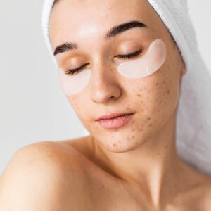 îngrijirea-tenului-gras îngrijirea-tenului-gras