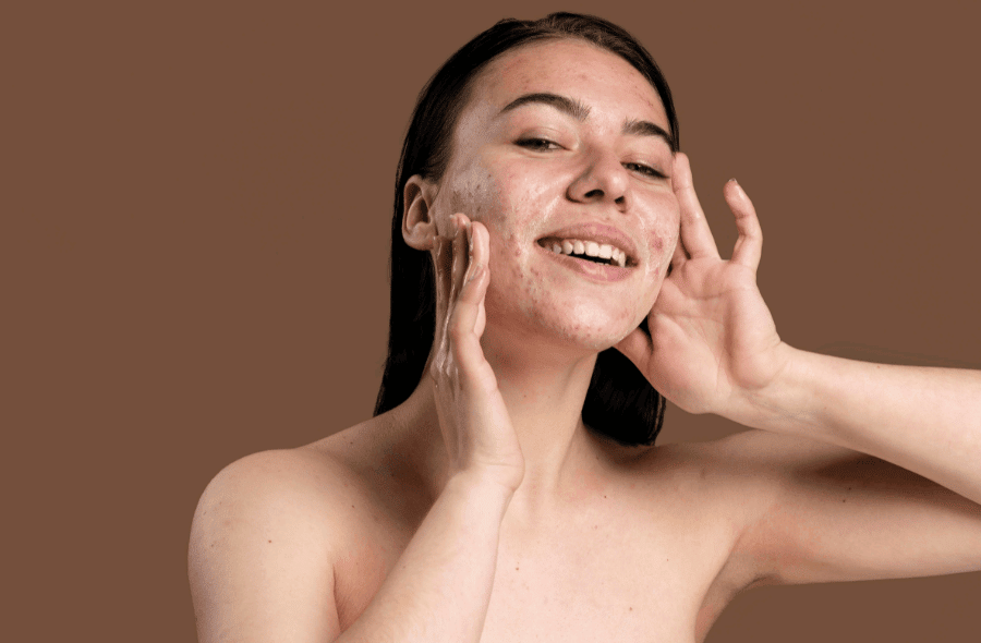 Produsele cu cbd ideale pentru echilibrarea secretiei de sebum Produse pentru ingrijirea tenului gras