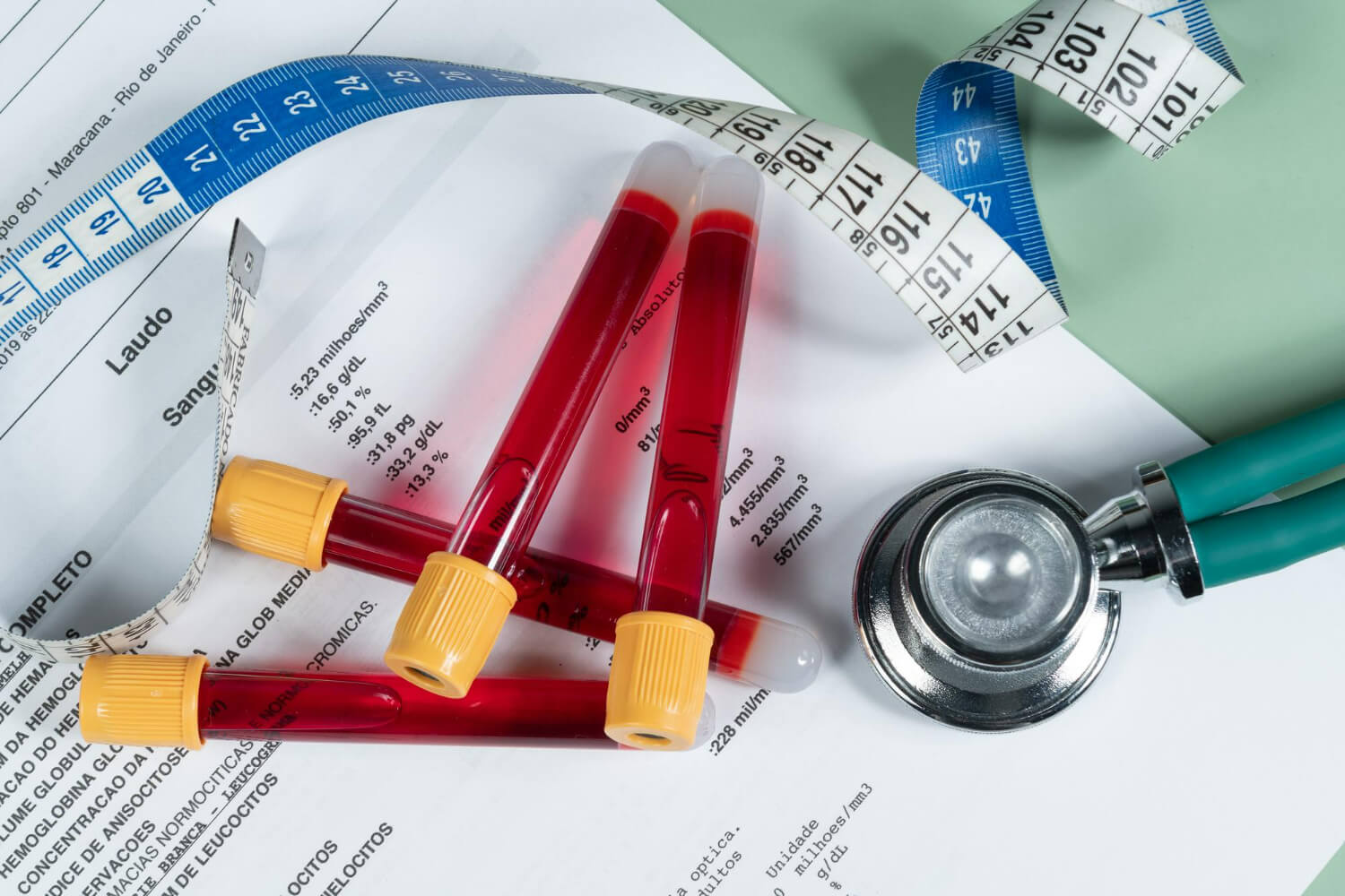 Suplimente pentru colesterol Suplimente pentru colesterol