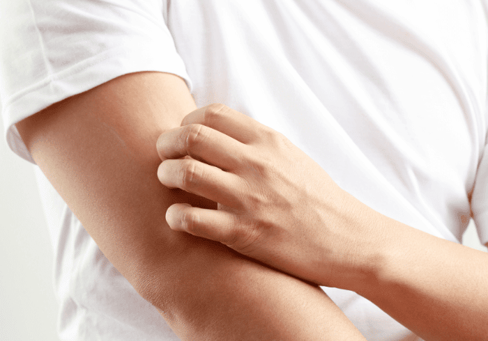 Cartilaj de rechin pentru psoriasis