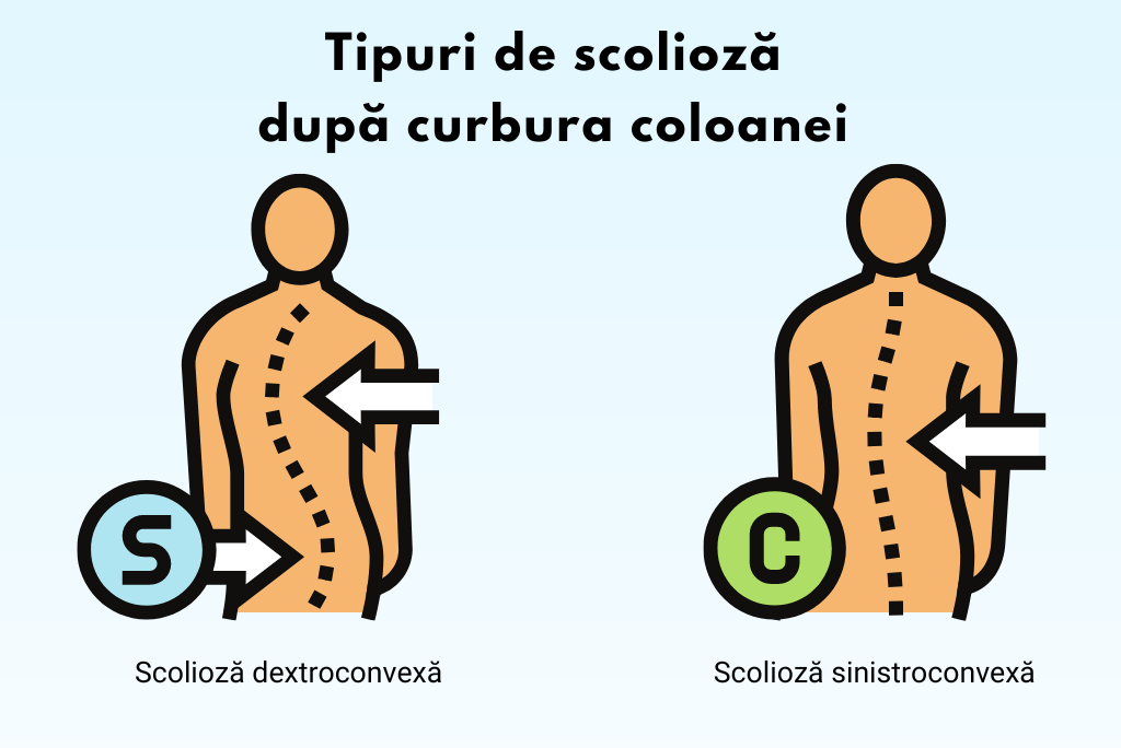 Scolioza dextroconvexa