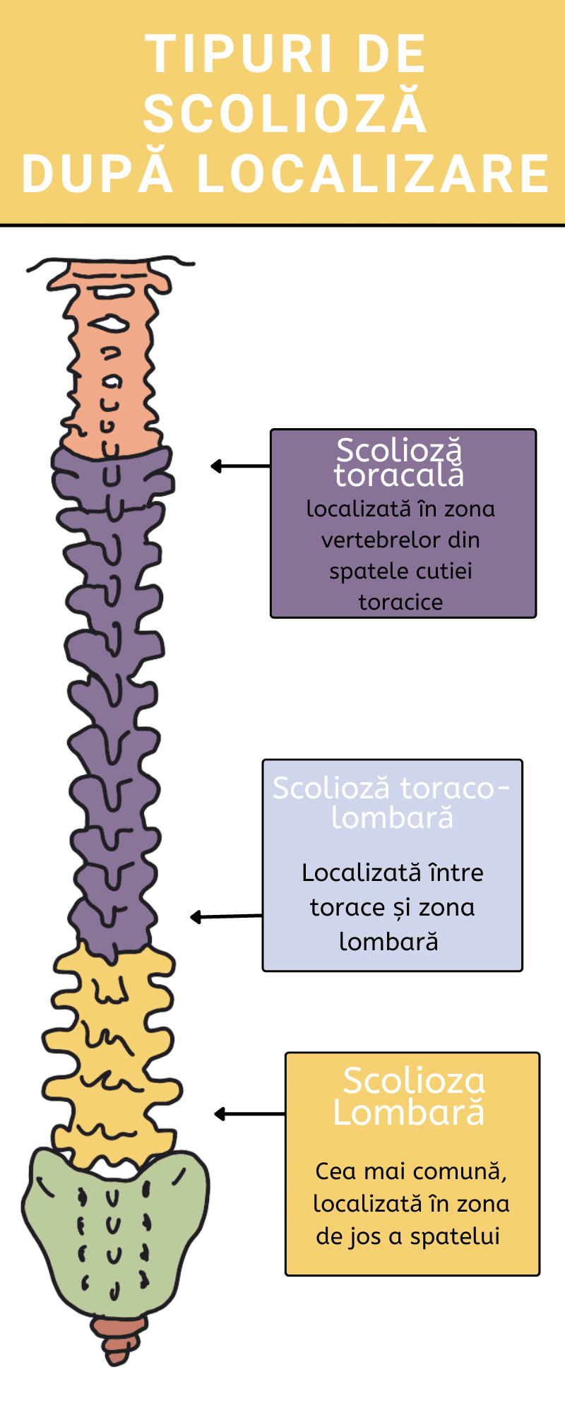 Tipuri de spondiloza