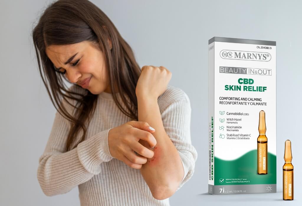 Cbd skin relief: ajuta la prevenirea dermatitei atopice Cbd skin relief: ajuta la prevenirea dermatitei atopice
