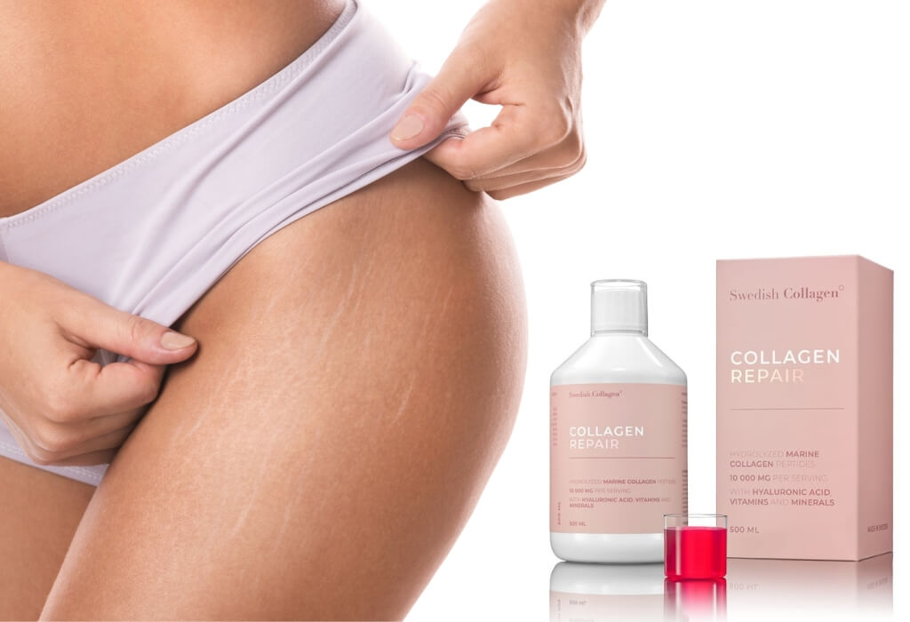 Colagen repair - tratament impotriva vergeturilor