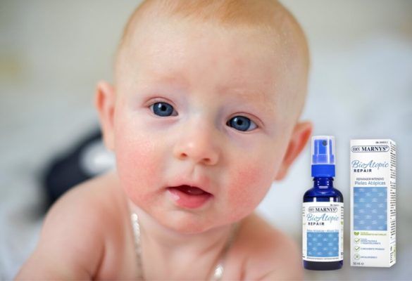 Bioatopic repeair - remediu copii, bebelusi, adulti pentru dermatita