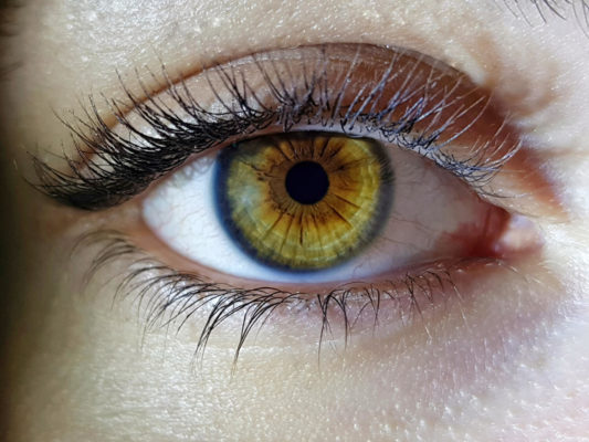 Astigmatism