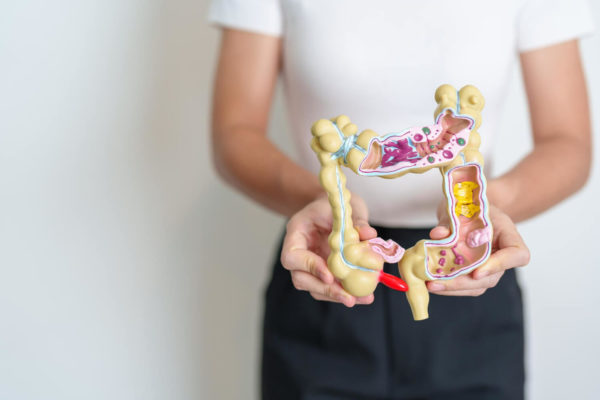Boala crohn